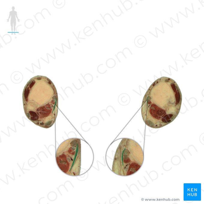 Retinaculum flexorum pedis (Halteband der Beugesehnen des Fußes); Bild: National Library of Medicine