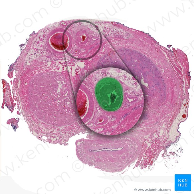 Artère dorsale du pénis (Arteria dorsalis penis); Image : 