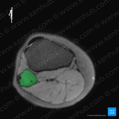Fibula; Image: 