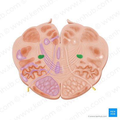 Nucleus ambiguus (Ambiguuskern); Bild: Paul Kim