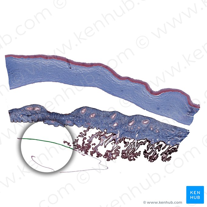 Lens; Image: 