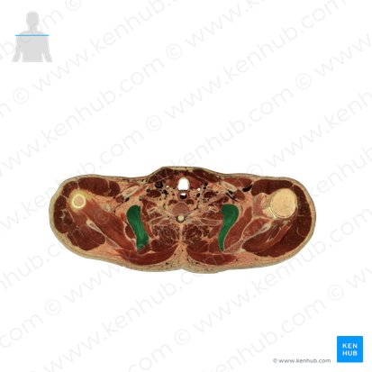 Musculus serratus anterior (Vorderer Sägemuskel); Bild: National Library of Medicine