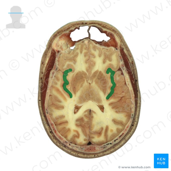 Insula; Image: National Library of Medicine