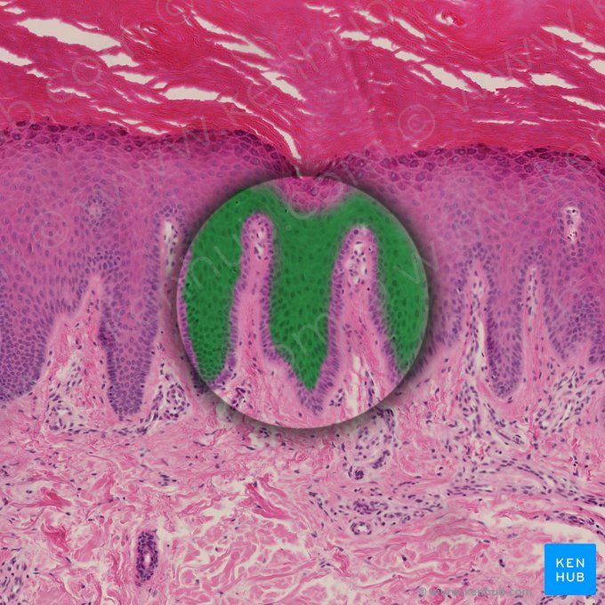 Stratum spinosum epidermis (Stachelzellschicht der Epidermis); Bild: 