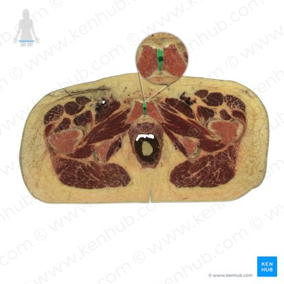Symphysis pubica (Schambeinfuge); Bild: National Library of Medicine