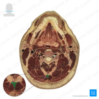 Nuchal ligament (Ligamentum nuchae); Image: National Library of Medicine