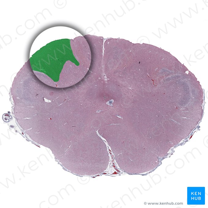 Cuneate fasciculus (Fasciculus cuneatus); Image: 