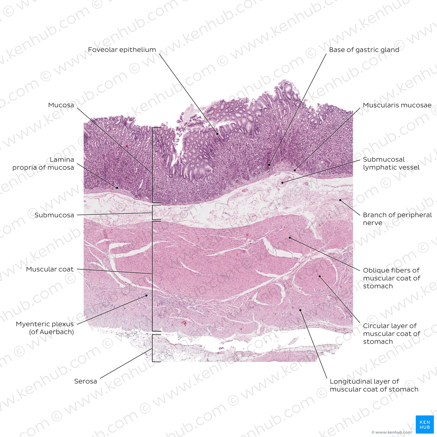 Stomach wall. Stain: H&E. Low magnification.