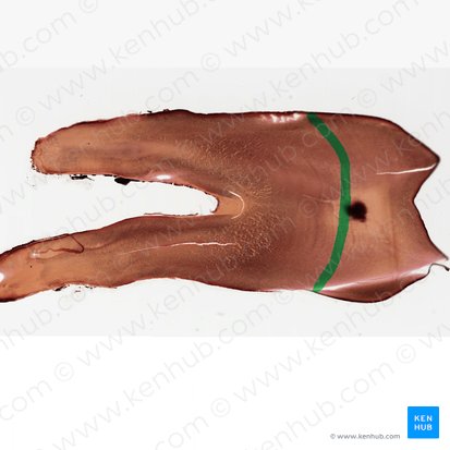 Schmelz-Dentin-Grenze; Bild: 