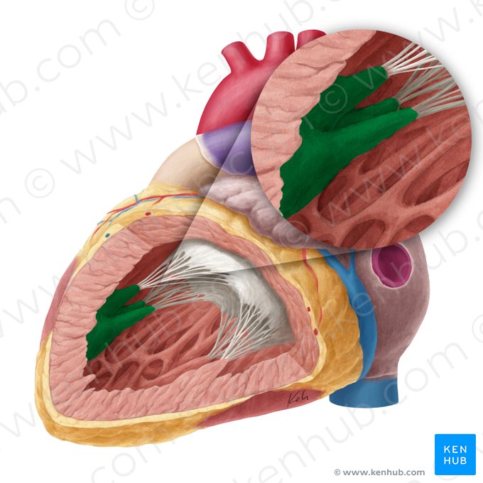 Superior papillary muscle of left ventricle (Musculus papillaris superior ventriculi sinistri); Image: Yousun Koh