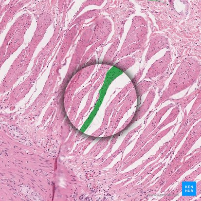 Fasciculus muscularis levis (Glattes Muskelbündel); Bild: 