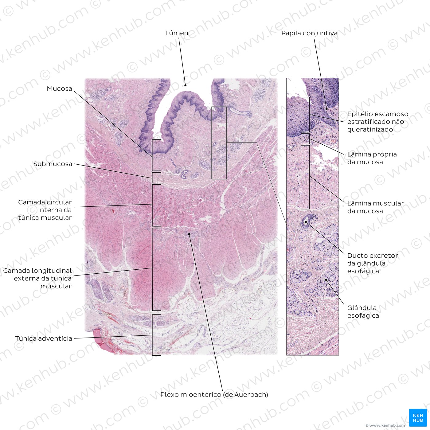 Esophagus in cross section. Stain: H&E. Medium magnification