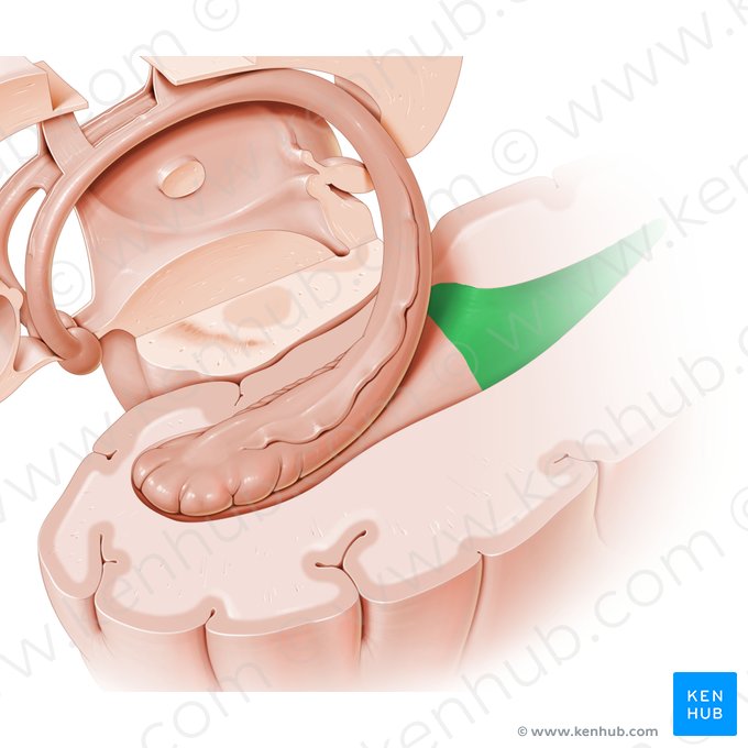 Occipital horn of lateral ventricle (Cornu occipitale ventriculi lateralis); Image: Paul Kim