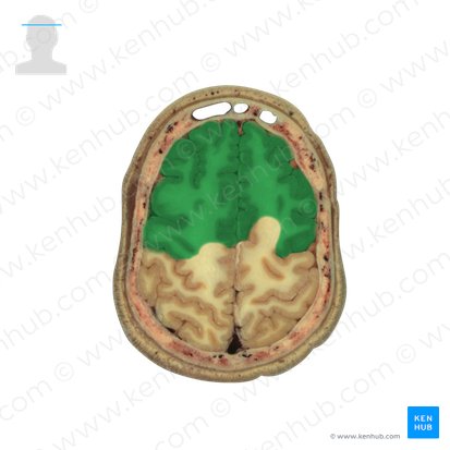 Lobus frontalis (Stirnlappen); Bild: National Library of Medicine