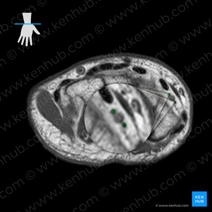 Radial veins (Venae radiales); Image: 