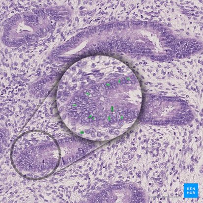 Mitosis of epithelial cells; Image: 