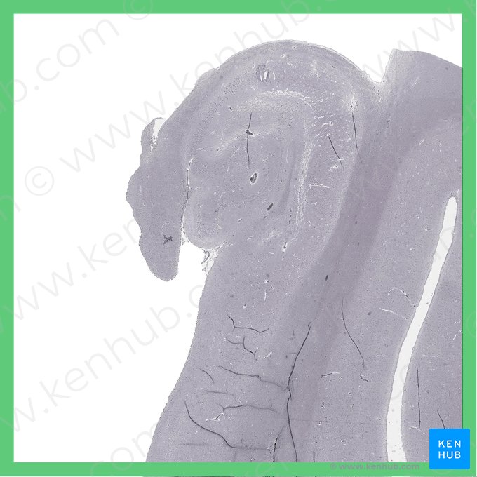 Hippocampusregion; Bild: 