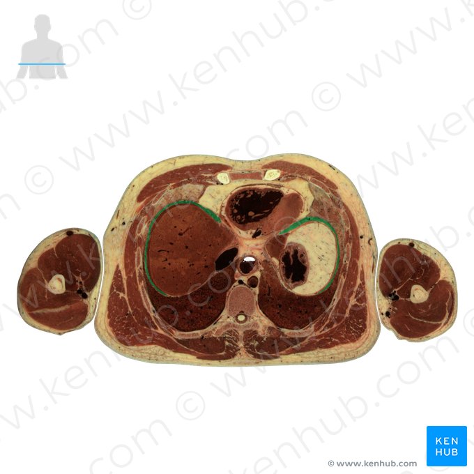 Diaphragm (Diaphragma); Image: National Library of Medicine