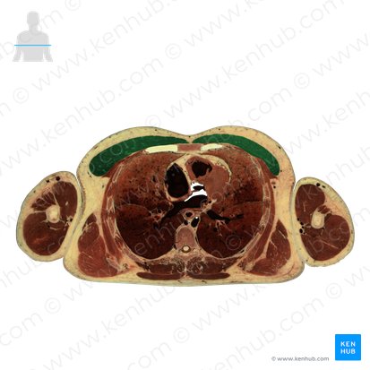 Musculus pectoralis major (Großer Brustmuskel); Bild: National Library of Medicine