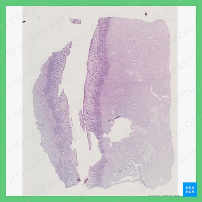 Midproliferative phase (Uterus) (Phasis proliferativa intermedia (Uterus)); Image: 