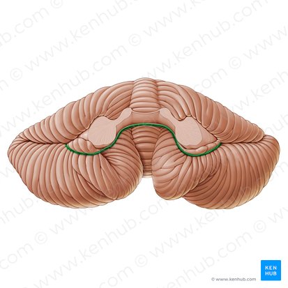 Posterolateral fissure of cerebellum (Fissura posterolateralis cerebelli); Image: Paul Kim