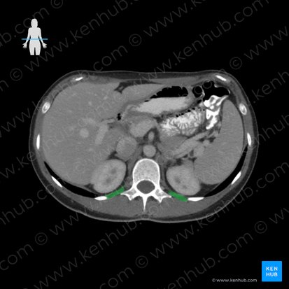 Musculus quadratus lumborum (Viereckiger Lendenmuskel); Bild: 