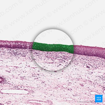 Nonkeratinized stratified squamous epithelium (Epithelium stratificatum squamosum non cornificatum); Image: 