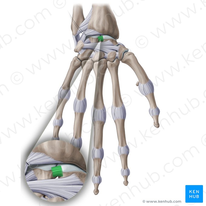 Scapholunate interosseous ligament (Ligamentum scapholunatum interosseum); Image: Paul Kim