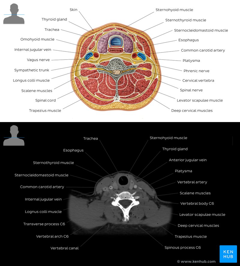 Neck CT at C6 level and normal neck anatomy diagram