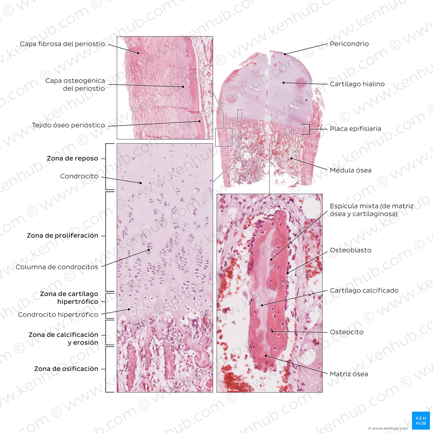 Endochondral and periosteal ossification. Stain: H&E.