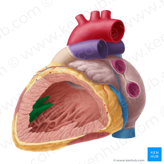 Superior papillary muscle of left ventricle (Musculus papillaris superior ventriculi sinistri); Image: Yousun Koh
