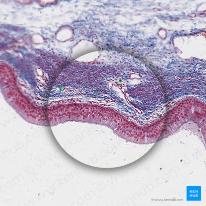 Lymphocyte (Lymphocytus); Image: 