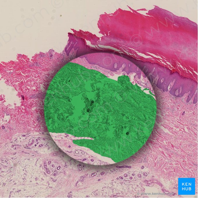 Stratum reticulare dermis (Retikularschicht der Dermis); Bild: 