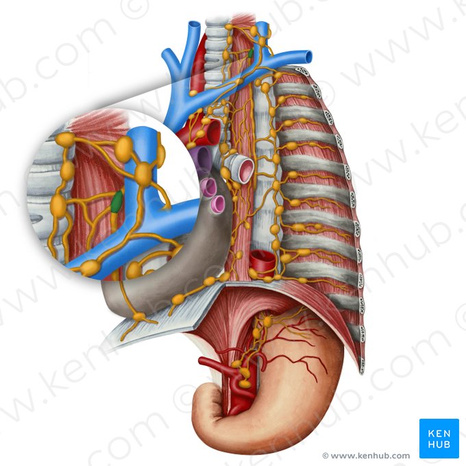 Left supraclavicular lymph node (Nodus lymphaticus supraclavicularis sinister); Image: Irina Münstermann