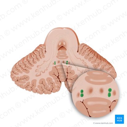 Globose nucleus (Nucleus globosus); Image: Paul Kim