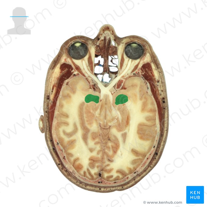 Corpus amygdaloideum (Amygdala); Bild: National Library of Medicine