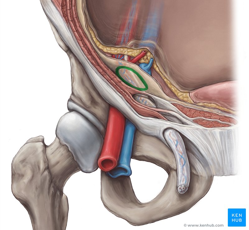 Deep inguinal ring