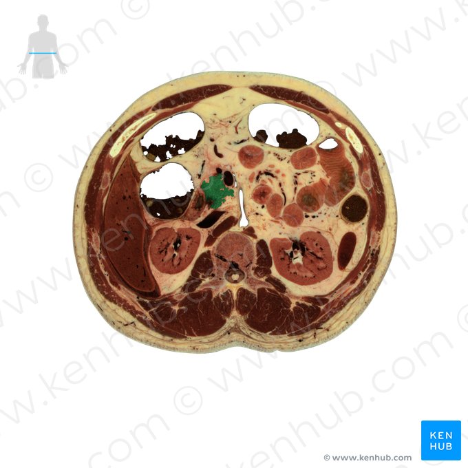 Pancreas; Image: National Library of Medicine