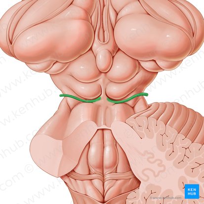 Trochlear nerve (Nervus trochlearis); Image: Paul Kim