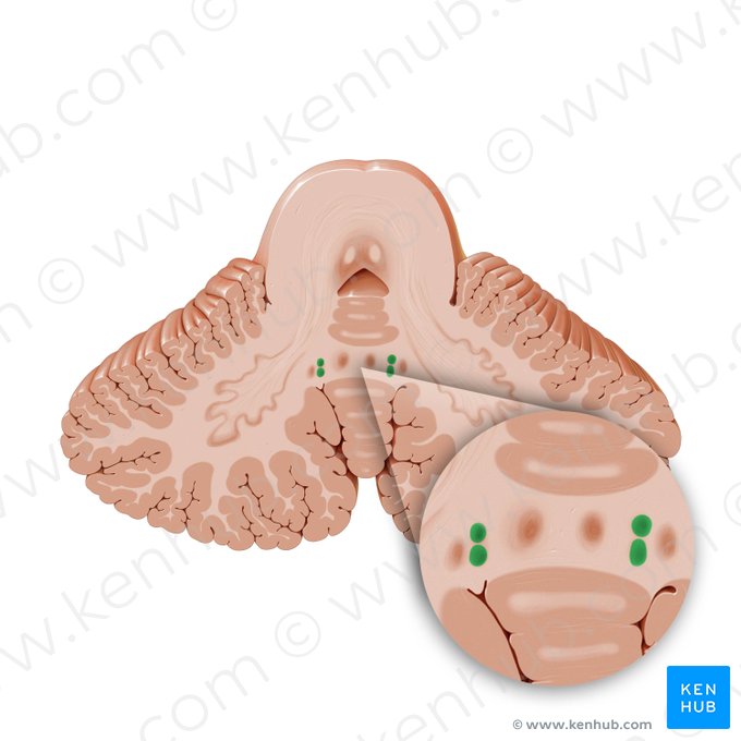 Globose nucleus (Nucleus globosus); Image: Paul Kim