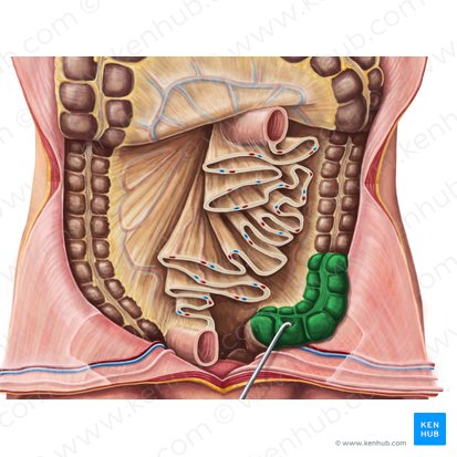 Sigmoid colon (Colon sigmoideum); Image: Irina Münstermann