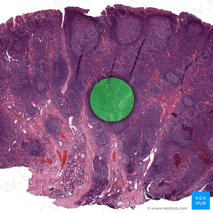 Reticular connective tissue; Image: 