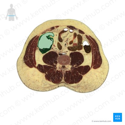 Colon ascendens (Aufsteigender Dickdarm); Bild: National Library of Medicine