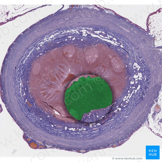 Tunica mucosa (Mukosa); Bild: 