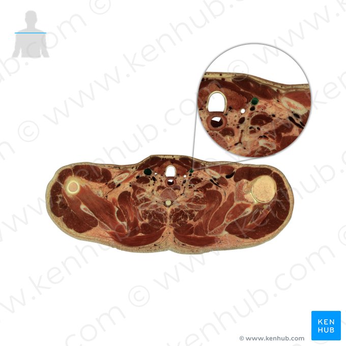 Veia jugular interna (Vena jugularis interna); Imagem: National Library of Medicine