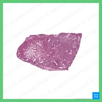 Parathyroid gland (Glandula parathyroidea); Image: 