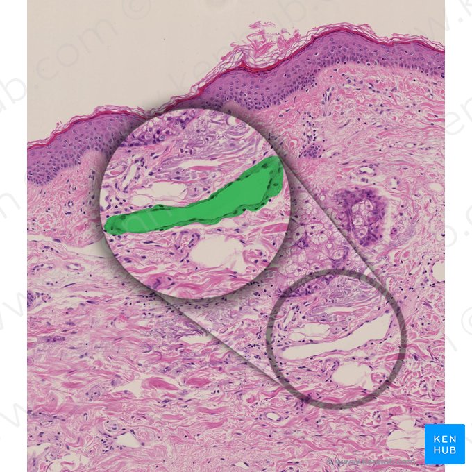Vas lymphaticum dermis (Lymphgefäß der Demis); Bild: 