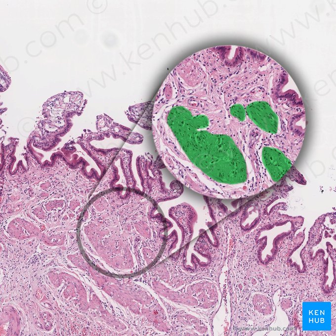 Fasciculus muscularis levis (Glattes Muskelbündel); Bild: 
