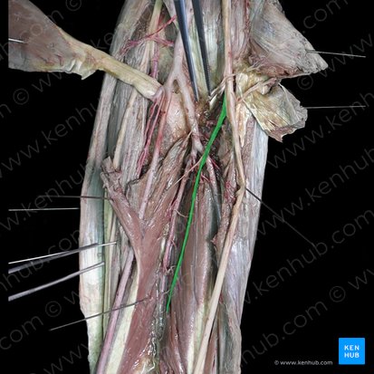 Anterior interosseous nerve (Nervus interosseus anterior); Image: 