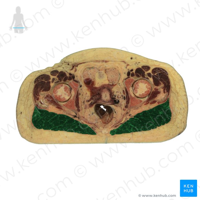 Musculus gluteus maximus (Großer Gesäßmuskel); Bild: National Library of Medicine